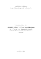 Segmentacija zakrivljenih krvnih žila u slikama očne pozadine