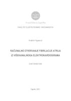 Računalno otkrivanje fibrilacije atrija iz višekanalnoga elektrokardiograma