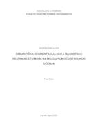prikaz prve stranice dokumenta Semantička segmentacija slika magnetske rezonance tumora na mozgu pomoću strojnog učenja